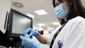 Über 1000 Affenpocken-Fälle in Deutschland gemeldet