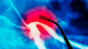 Schwache Stütze fürs Herz