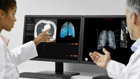 Ersetzt Künstliche Intelligenz den Radiologen?