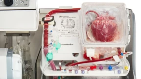 Künstliche Durchblutung soll Organe retten