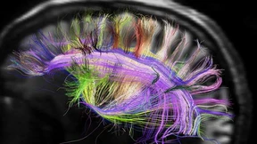 Endlich kommt Licht ins Dunkel