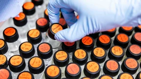 Das ist beim Kauf vom Hochzinsanleihen entscheidend