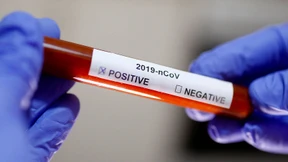 Biotech-Aktienindex könnte kräftig steigen