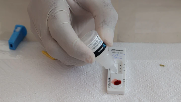 Ein Schnelltest für HIV