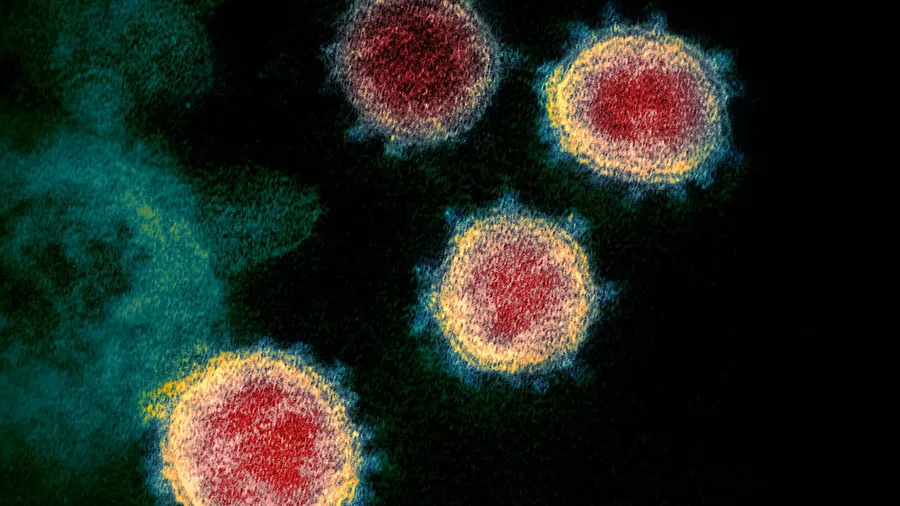 Effizienter Eroberer: Das Sars-Coronavirus 2 befällt Körperzellen und zwingt sie, neue Viruspartikel herzustellen.