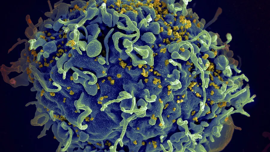 Angriff auf das Immunsystem: HI-Viren (gelb) attackieren eine menschliche T-Zelle (blau).
