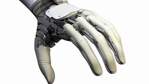 Moderne Handprothese: Allerlei Parallelen zur Formel 1