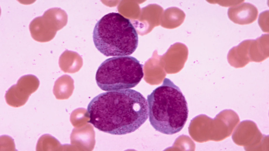 Wie Leukämiezellen die Grippe bekommen