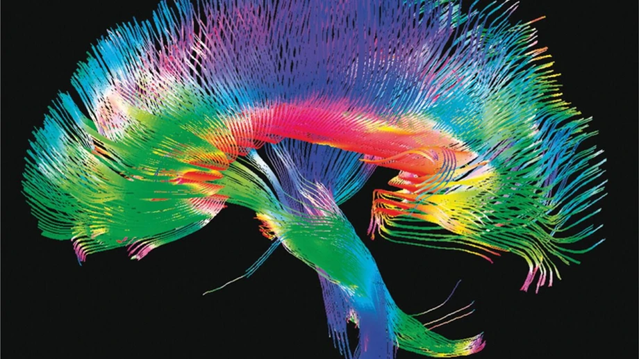 Ein Zwilling fürs Gehirn