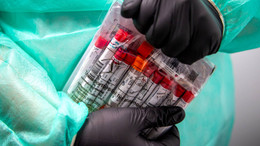 Delta breitet sich schnell in Deutschland aus