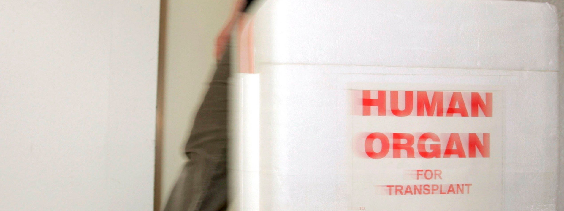 Diskussion Um Organspende Herztod Politik Faz