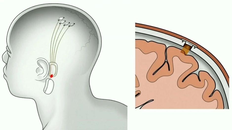 Gehirn Aktuell News Und Informationen Der Faz Zum Thema