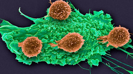 Die Designer-Killerzellen