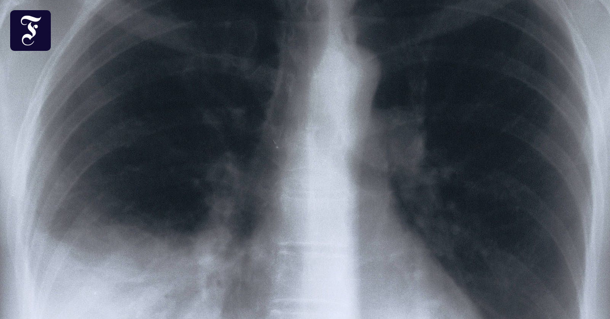 Woher Weiß Ich Ob Bronchitis Oder Lungenentzündung www.faz.net