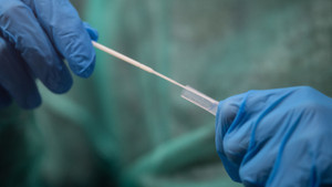 Die Sieben-Tage-Inzidenz erreicht nächsten Höchstwert von 894,3