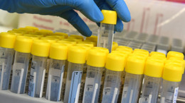 Sieben-Tage-Inzidenz und Neuinfektionen sinken