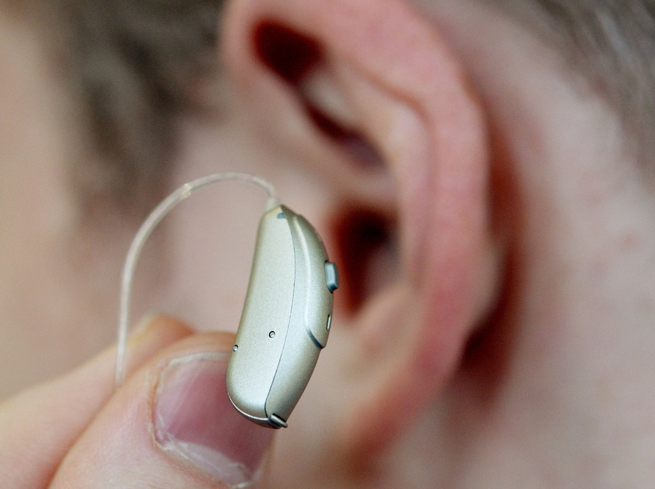 Bild zu Studie zu Hörgeräten und Demenz zurückgezogen Bild 1 von 1 FAZ