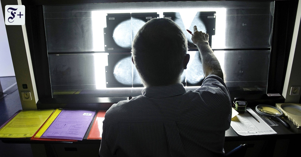Studie zur Hormonbehandlung provoziert Ärzte im Streit um Brustkrebs