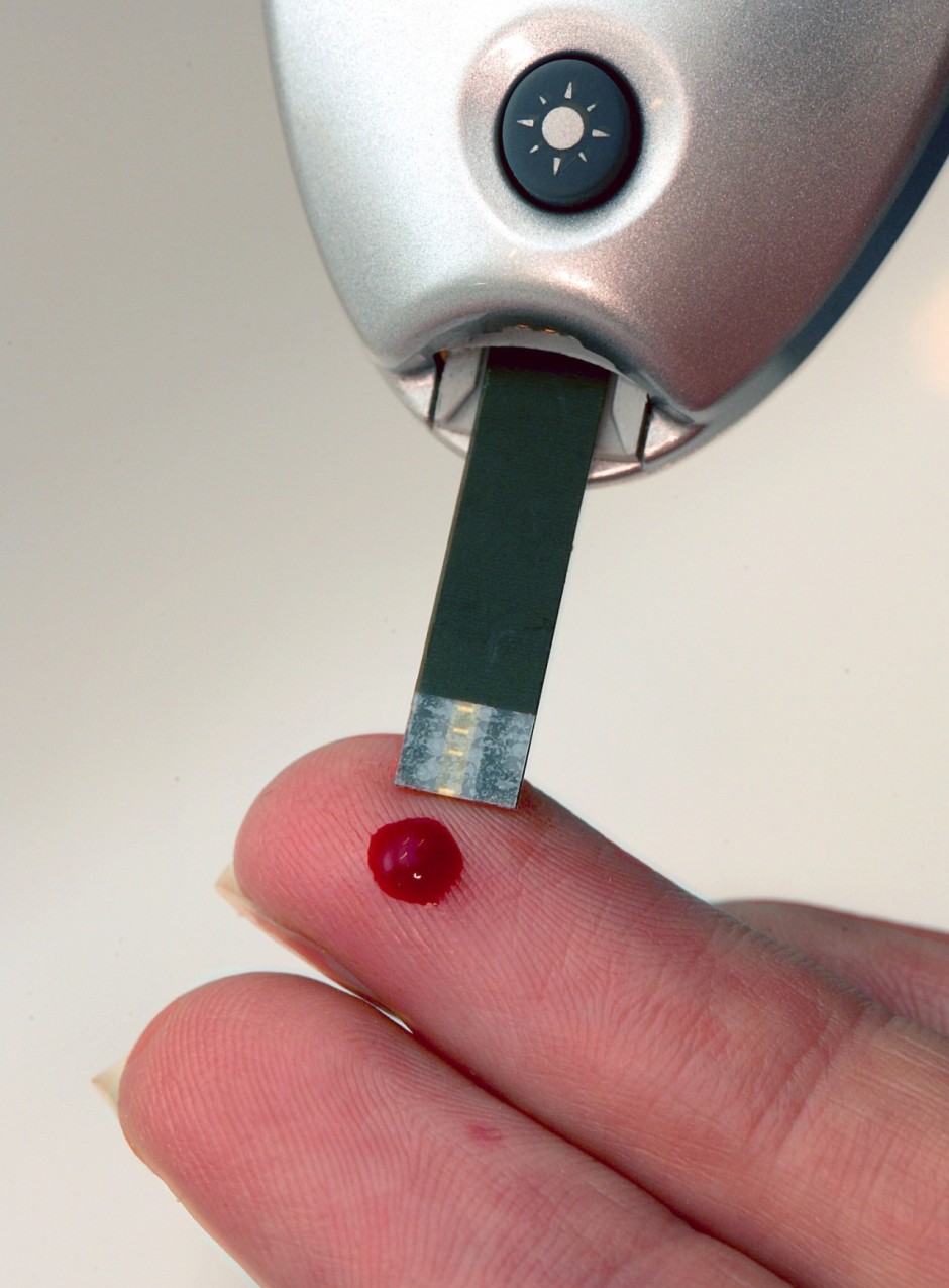 Bilderstrecke zu Wundheilung bei Diabetes Ein Protein mit Potential Bild 1 von 2 FAZ Bilderstrecke zu Wundheilung bei Diabetes Ein Protein mit Potential Bild 1 von 2 FAZ