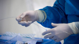 Vorbereitung des Katheter-Eingriffs.