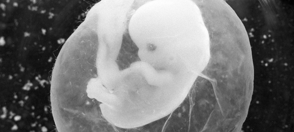 Bildergebnis fÃ¼r Shenzhener UniversitÃ¤t, medizen genforschung. kostenlosen bilder