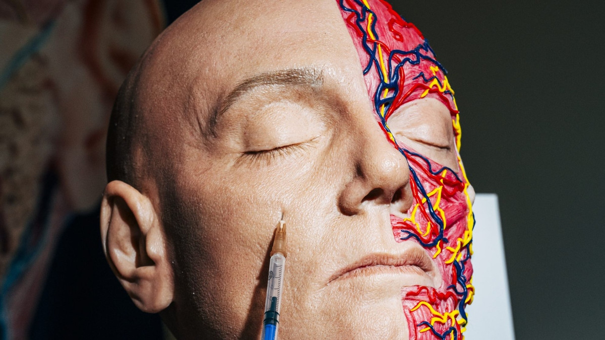 Deep-Plane-Facelift: Nie wieder Jokerface!