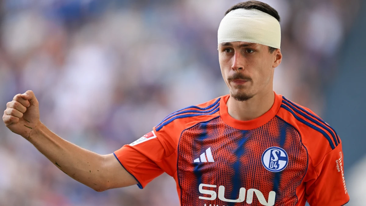 Gezeichnet, aber erfolgreich: Ron Schallenberg erleidet eine Kopfwunde, Schalke gewinnt dennoch. - dpa