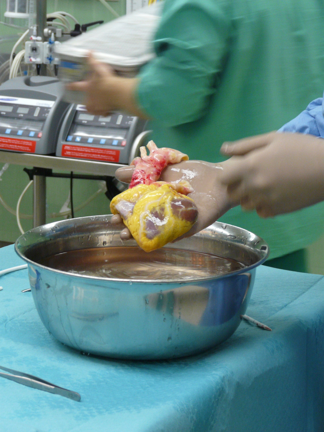 Archivbild von 2008: Ein Oberarzt einer deutschen Universitätsklinik entnimmt ein Spenderherz aus einer Schale mit eiskalter Konservierungsflüssigkeit – kurz vor einer Transplantation.