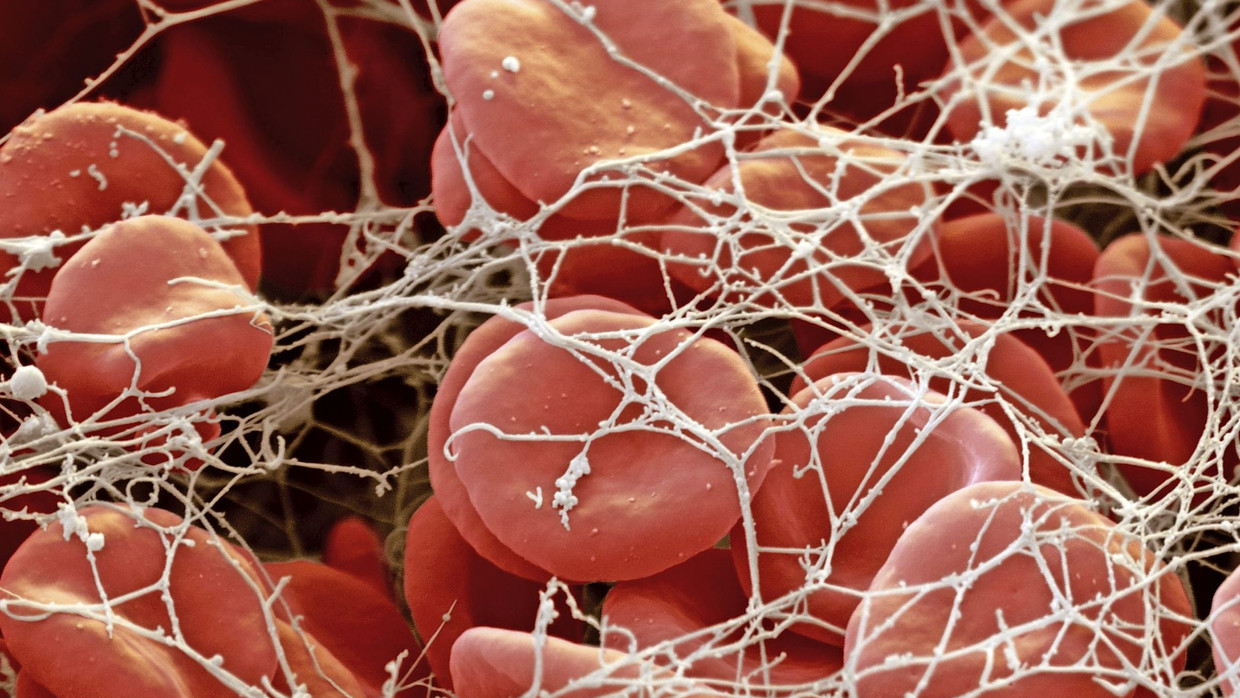 Rote Blutkörperchen Zu Wenig Ernährung www.faz.net