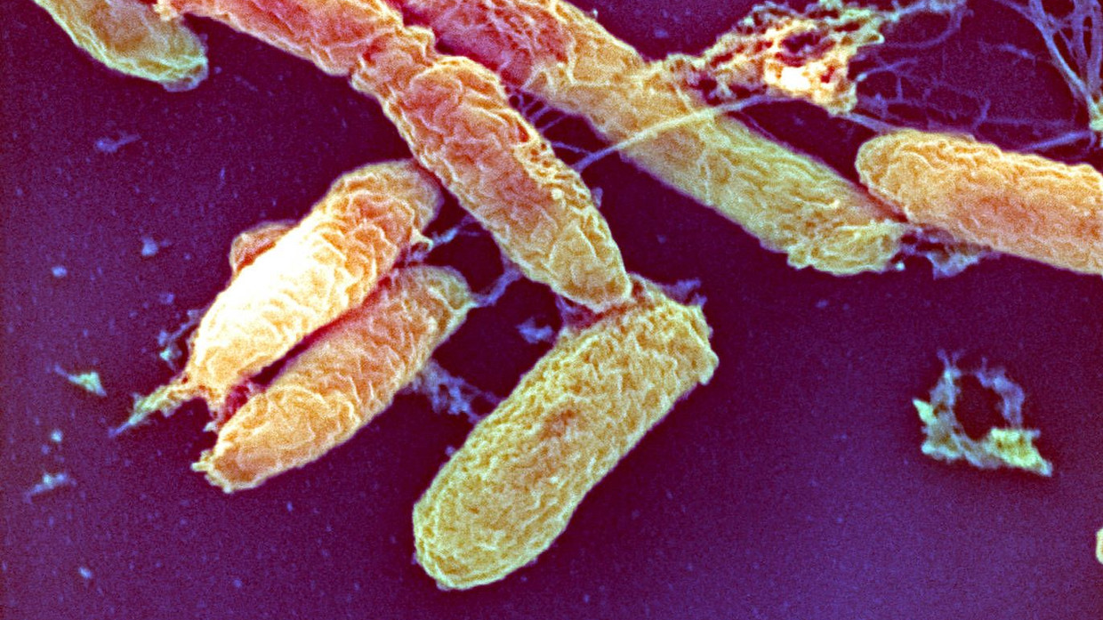 Sie sind noch da: Pesterreger unter dem Rasterelektronenmikroskop