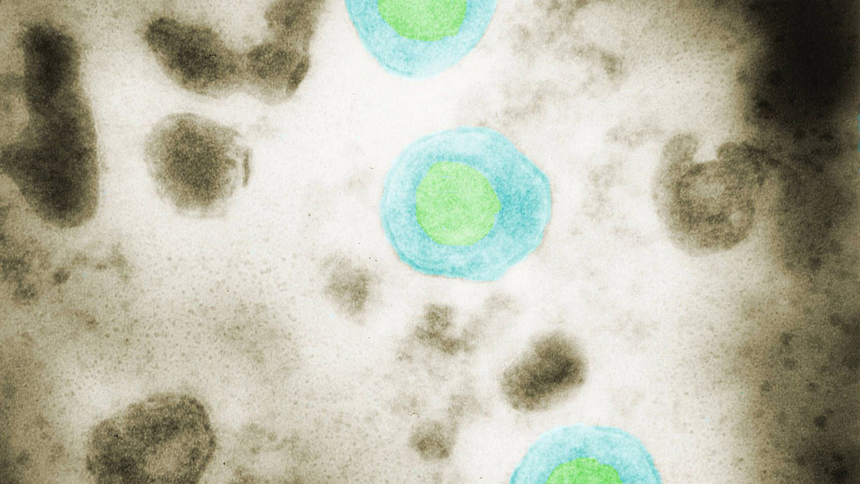 Wirkstoff Mit MagensäureBlocker gegen Herpes