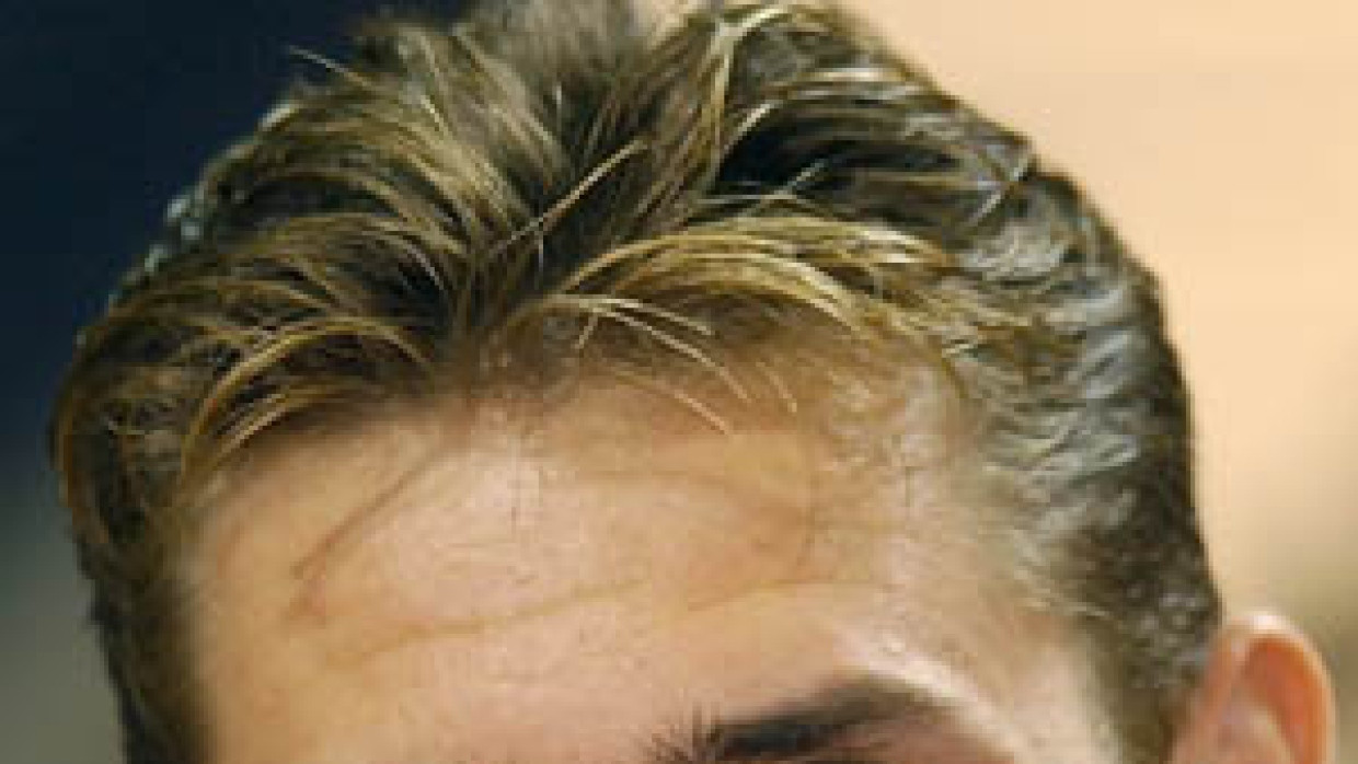 „Keine Schlägereien im Training”: Miroslav Klose