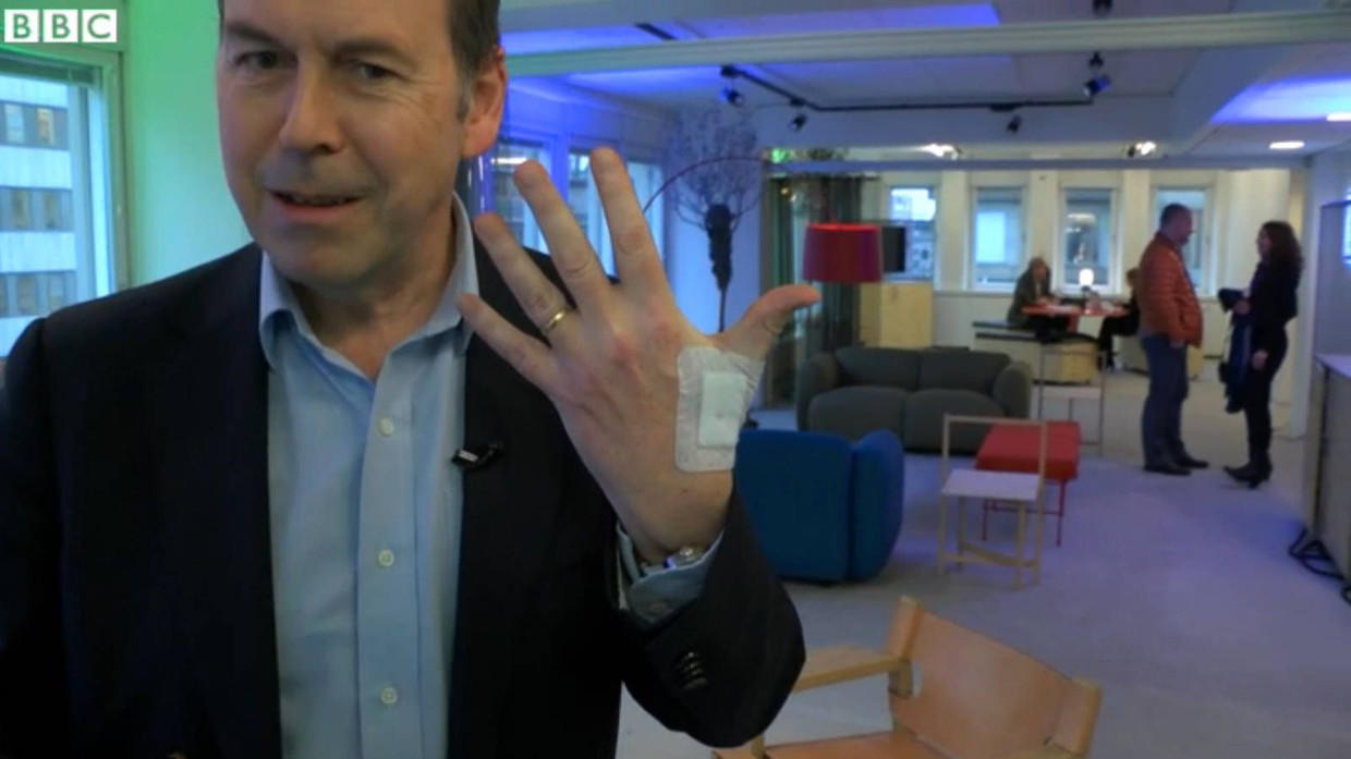 Pflaster mit Bedeutung: Hier hat sich der BBC-Reporter Rory Cellan-Jones einen Chip einpflanzen lassen.